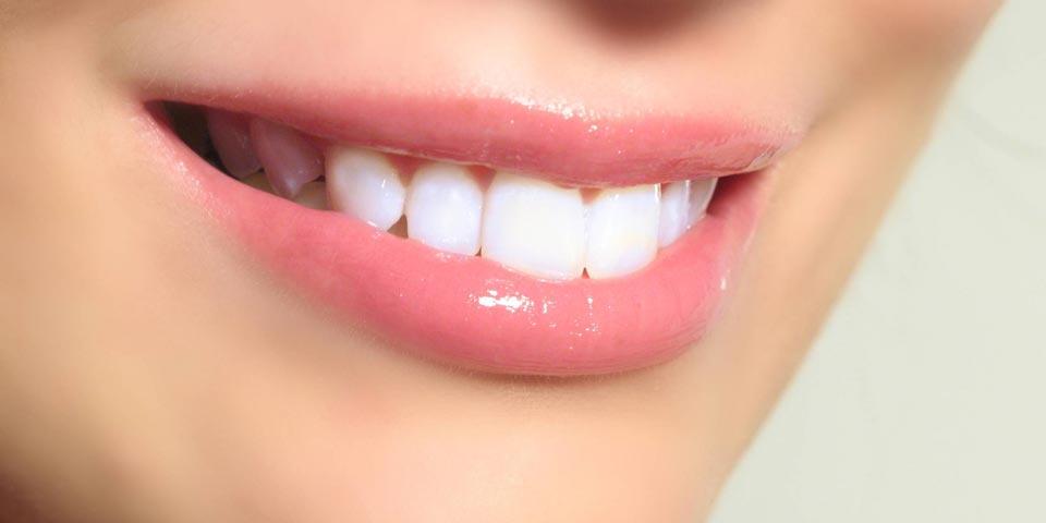 SAN SEVERO. Visita Odontoiatrica con  Pulizia Denti e Sbiancamento denti a partire da  soli Euro 19,00 a  persona, dal Dott. Marco Nardella.