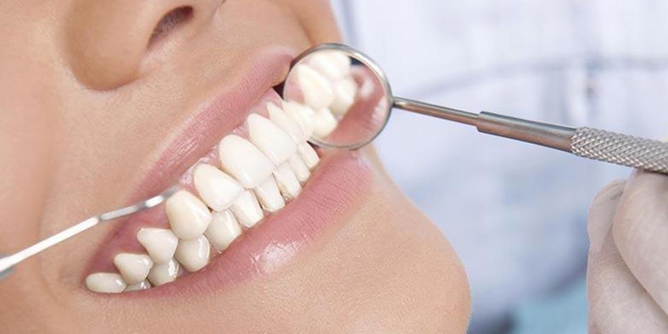 MOLA DI BARI. 1 o 2 Sedute di Pulizia Denti con Detartrasi e Smacchiamento a partire da soli Euro 19,90 a persona, dal Dott. Raffaele Cavallaro.