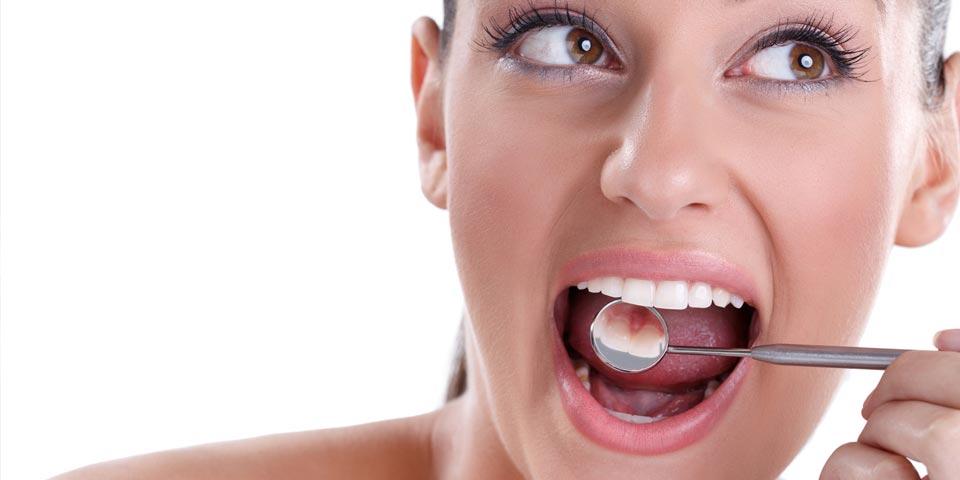 BARI. Visita  Odontoiatrica con  Pulizia Denti e Smacchiamento a soli Euro 19,00 per una persona,  dal  Dott. Giuseppe De Santis.